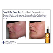 iS Clinical Pro Heal Serum Advance+ 高效防禦精華