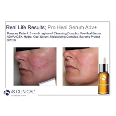 iS Clinical Pro Heal Serum Advance+ 高效防禦精華