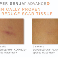 iS Clinical Super Serum Advance 特效煥膚精華素 60ml