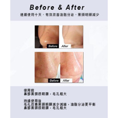 Beauty Quest Renovating Serum  淨化黑頭粉刺精華